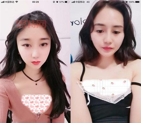 青柠直播app下载:丰富直播内容,每天精彩不停歇